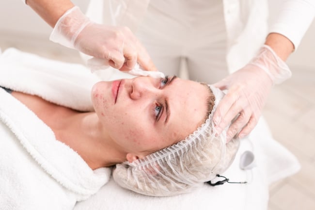 acne treatments from a cosmetic dermatologist